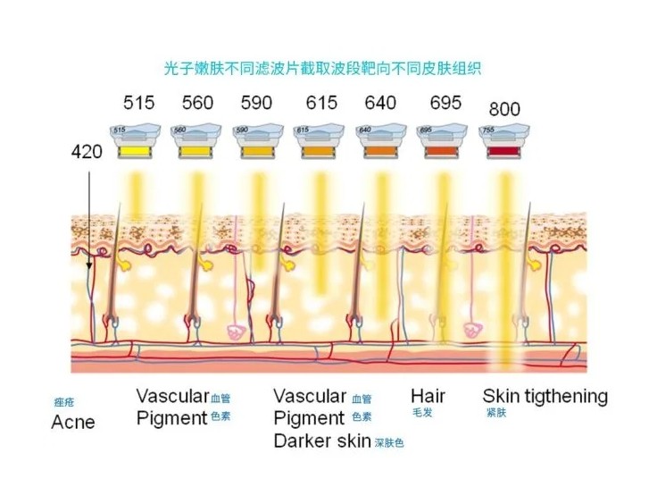 五大光子嫩膚技術(shù)（IPL、DPL、OPT、APT、BBL）及濾光片區(qū)別
