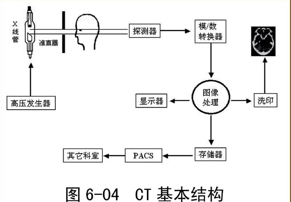 CT結(jié)構(gòu)原理